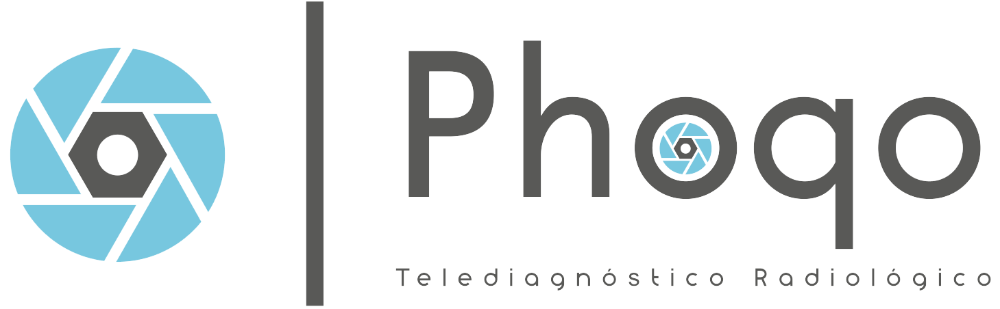 Logo de Phoqo